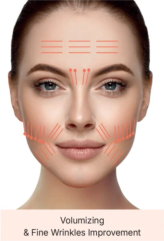 16/9 aspect ratio accessible description of the image
